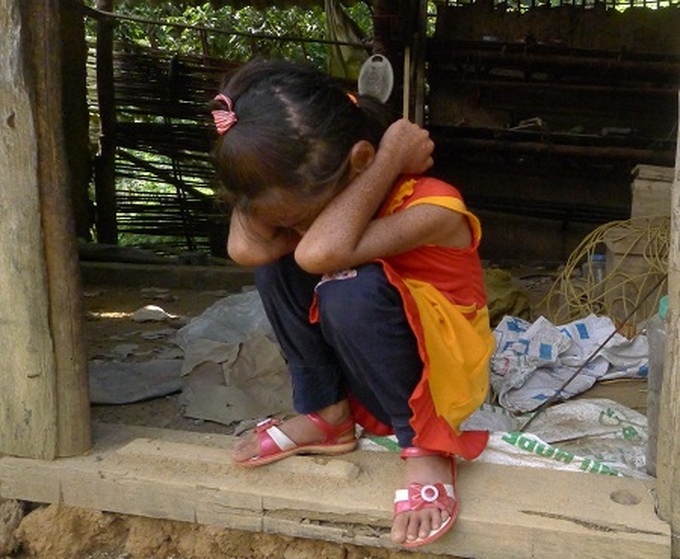 Help comes to little girl with strange skin disease - 1 Help comes to little girl with strange skin disease - 1