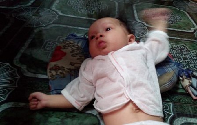 Baby suffers chronic pneumonia and heart disease - 1