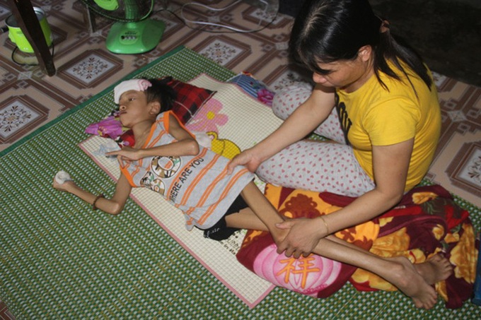 Little boy struggling with dangerous disease facing death risk - 1 Little boy struggling with dangerous disease facing death risk - 1