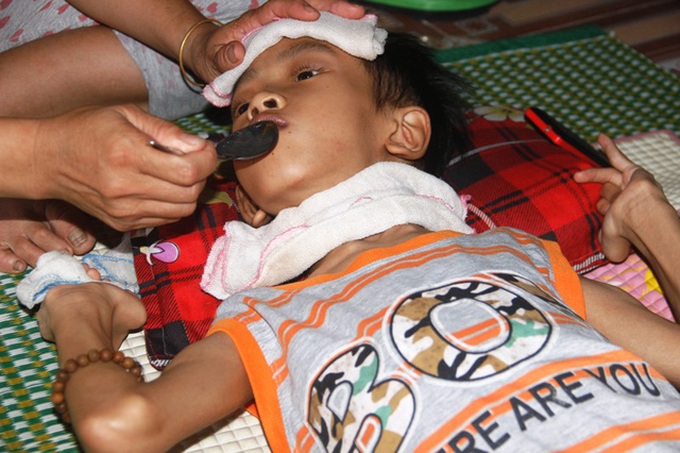 Little boy struggling with dangerous disease facing death risk - 2 Little boy struggling with dangerous disease facing death risk - 2