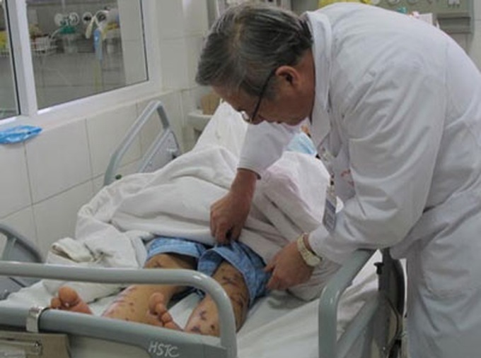 Hanoi confirms first meningitis death this year - 1