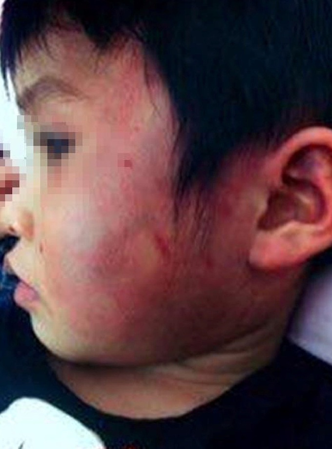 Teachers disciplined over lax anti-bullying efforts - 1