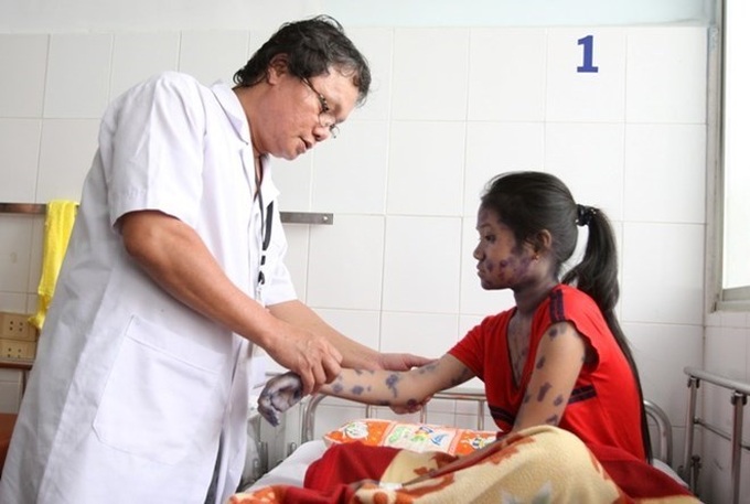 Southern region sees more chickenpox cases - 1
