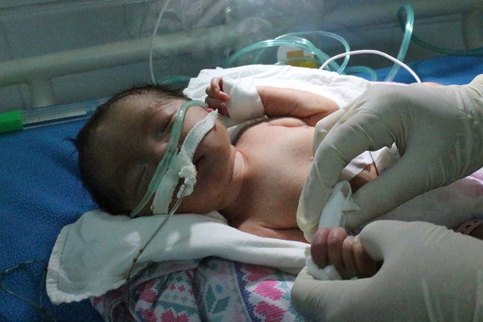 Mother and new-born face bird flu death - 2 Mother and new-born face bird flu death - 2