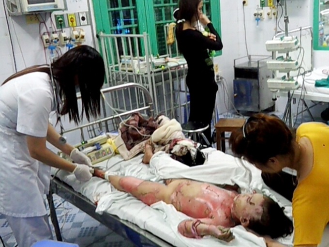 Man burns family after dispute over daughters - 1