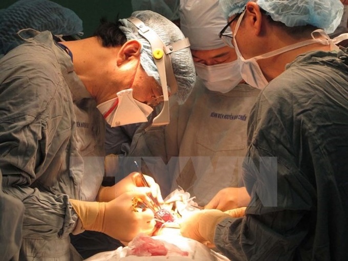 4,000 children with harelip undergo surgery - 1