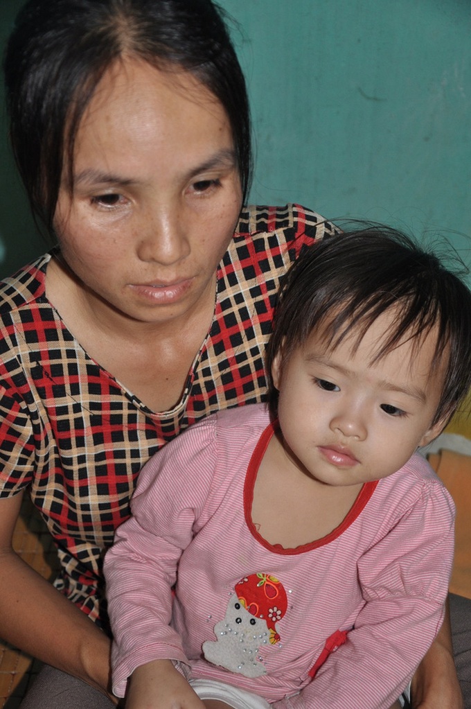 Mother to sell kidney to save small daughter - 2