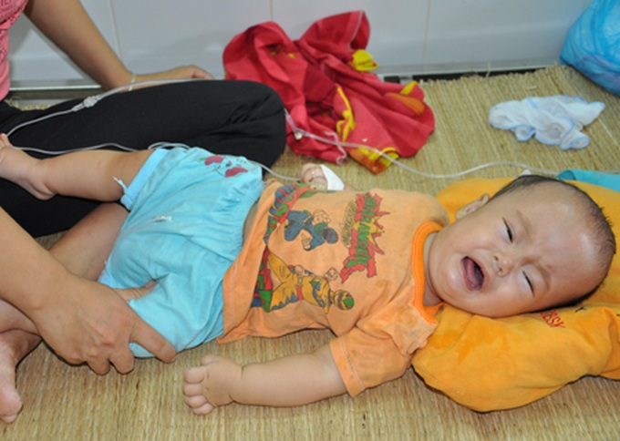 Baby struggles with hydrocephalus - 2 Baby struggles with hydrocephalus - 2