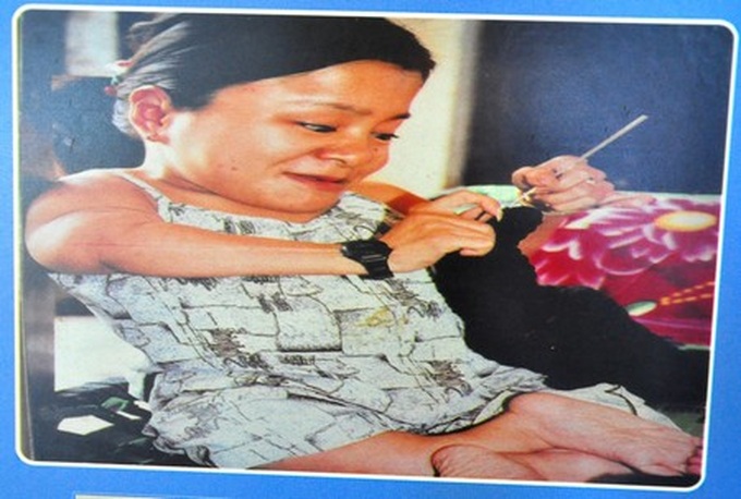 Exhibition features moving photos of AO/dioxin victims - 4 Exhibition features moving photos of AO/dioxin victims - 4