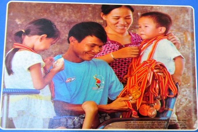 Exhibition features moving photos of AO/dioxin victims - 2 Exhibition features moving photos of AO/dioxin victims - 2