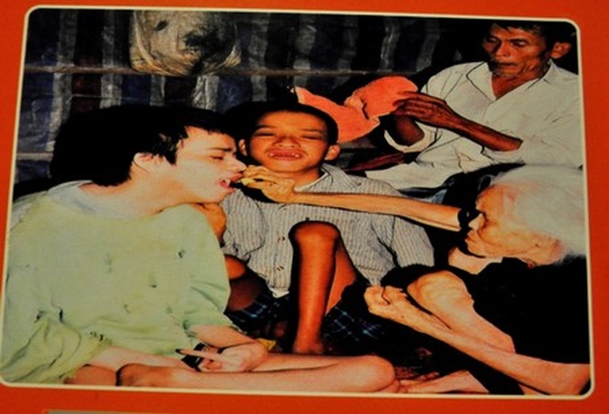 Exhibition features moving photos of AO/dioxin victims - 5 Exhibition features moving photos of AO/dioxin victims - 5