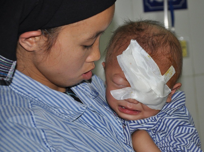 Little girl struggles with eye cancer - 1