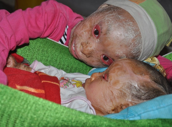 Couple calls for help for their “ghost” children - 1