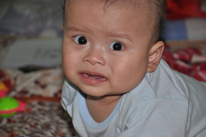 Little boy battles rare cancer - 1