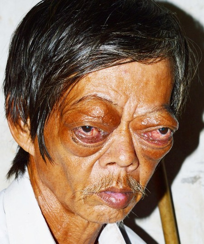 Hunger, illness blight man's struggle to support family - 1