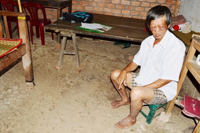 Hunger, illness blight man's struggle to support family - 3