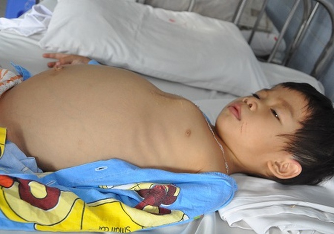 Couple seeks help to save daughter - 1