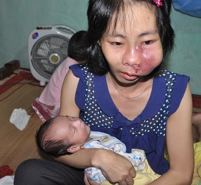 Mother on verge of death begs help for her children - 1 Mother on verge of death begs help for her children - 1