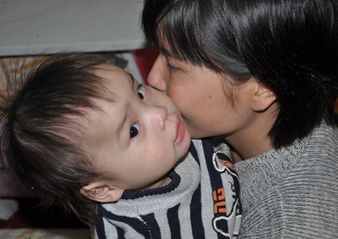 Near blind mother sings to support ill twins - 1