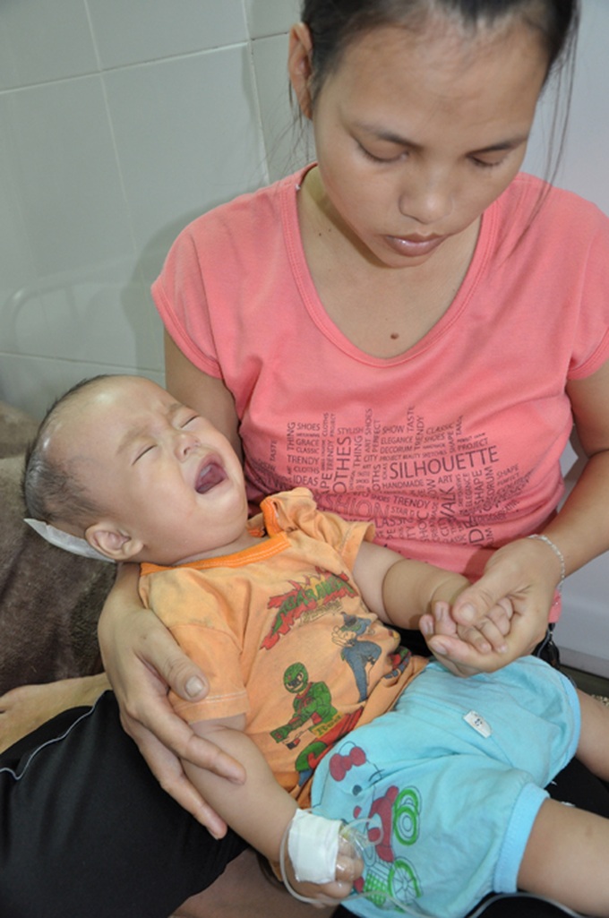 Baby struggles with hydrocephalus - 4 Baby struggles with hydrocephalus - 4