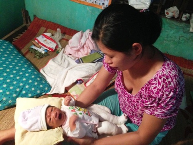 Couple seeks help for deformed newborn baby - 2 Couple seeks help for deformed newborn baby - 2