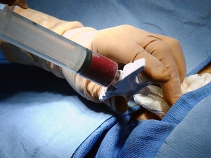 Vietnam hails success of first stem cell transplant - 1