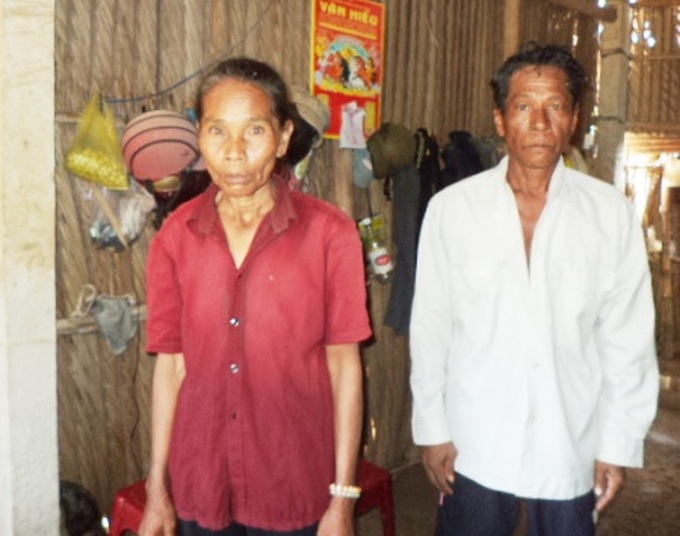 Khmer man bedridden for years due to deformed limbs - 3 Khmer man bedridden for years due to deformed limbs - 3