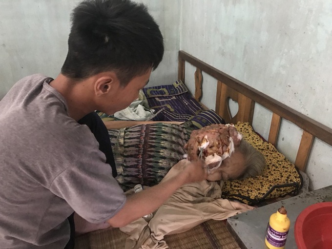 Vinh Long woman struggles cancer - 1 Vinh Long woman struggles cancer - 1