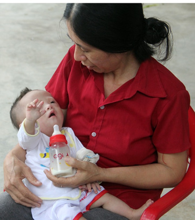 Malnourished baby fighting heart disease to survive - 1 Malnourished baby fighting heart disease to survive - 1