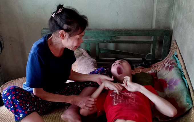 Ailing poor woman takes care of cerebral palsy son - 1 Ailing poor woman takes care of cerebral palsy son - 1