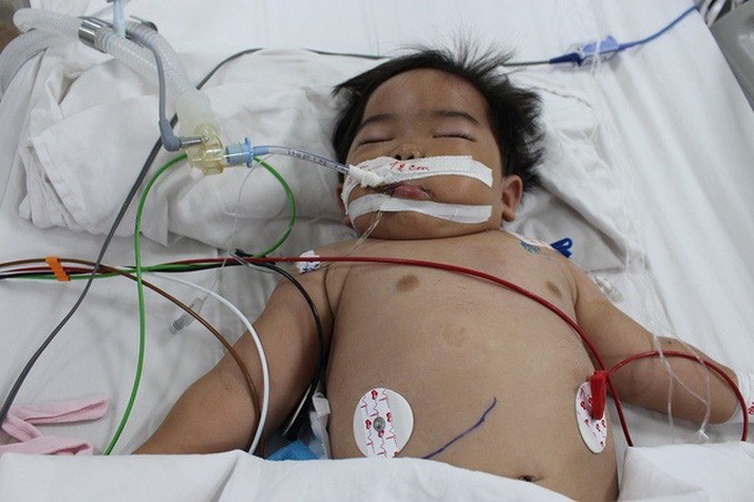 Little boy in critical condition after drinking petrol - 1 Little boy in critical condition after drinking petrol - 1