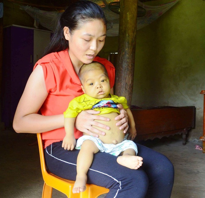 Little boy faces death risk due to serious diseases - 2 Little boy faces death risk due to serious diseases - 2