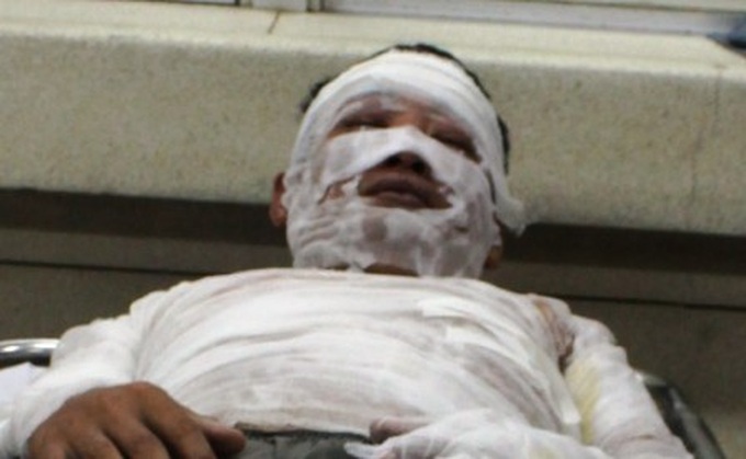 Gas explosion kills one and injures 17 - 4 Gas explosion kills one and injures 17 - 4