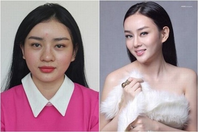 Cosmetic surgery en vogue among Vietnamese teens - 1 Cosmetic surgery en vogue among Vietnamese teens - 1