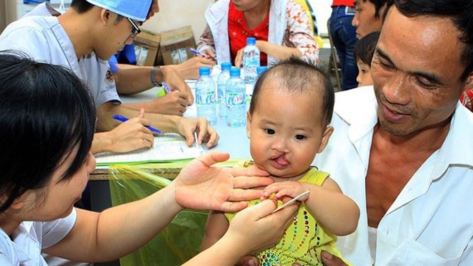 Additional 300 children recieve free smile surgeries - 1