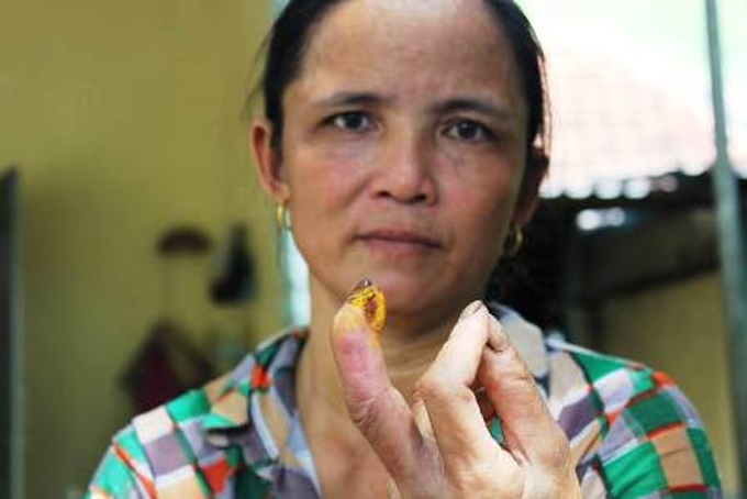 Invasive species worries people in Nghe An - 2