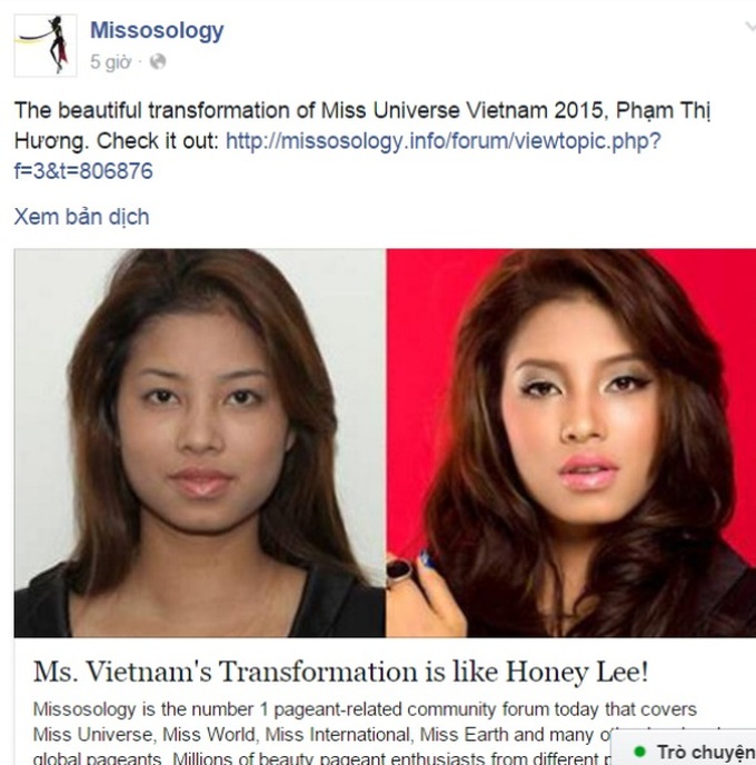 Miss Universe Vietnam suspected of undergoing plastic surgery - 1 Miss Universe Vietnam suspected of undergoing plastic surgery - 1