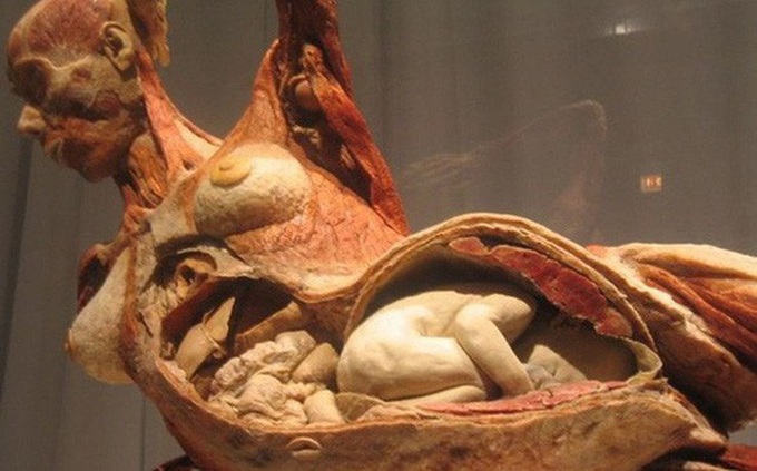 DTiNews - Mystery of the Human Body exhibition halted | Báo