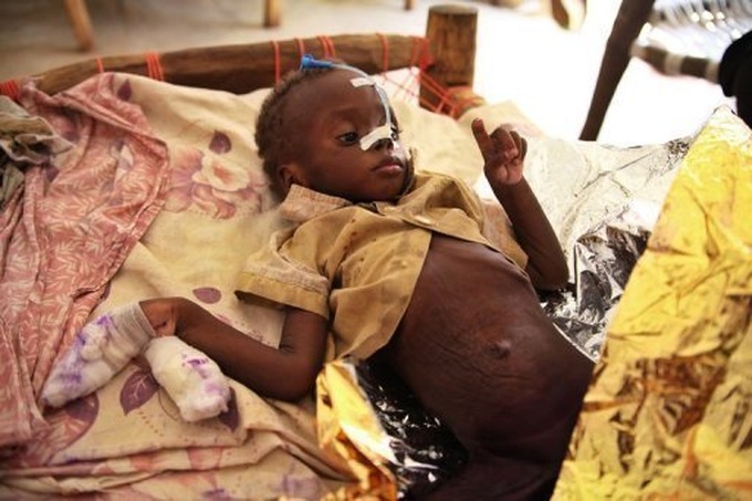 Global hunger down but progress slowing: UN - 1