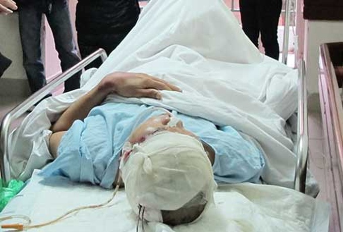 Traffic accidents kill 234 during Tet - 1