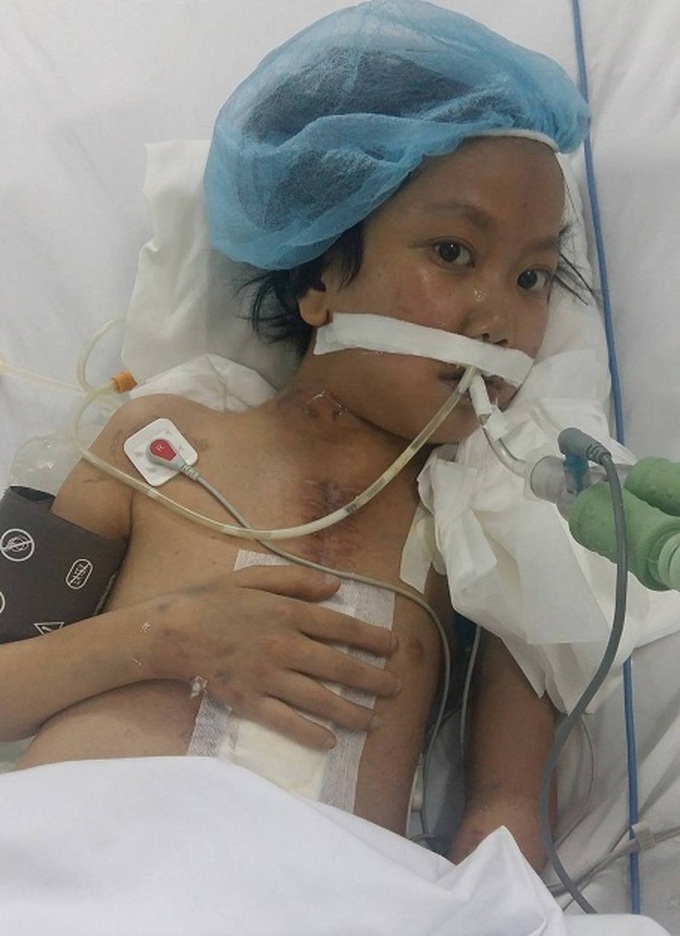 Poor Hoa Binh girl struggles with heart diseases - 1 Poor Hoa Binh girl struggles with heart diseases - 1