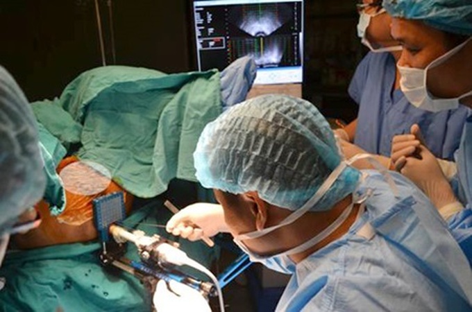 New treatment method prolongs liver cancer patients' lives - 1