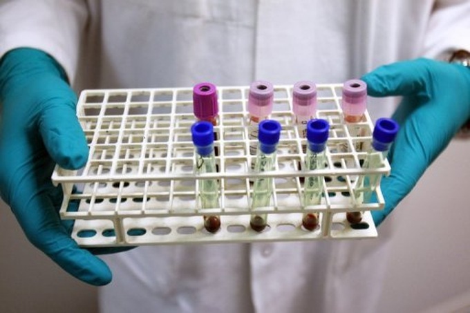 NGO sounds alarm on rising hepatitis deaths in Asia - 1