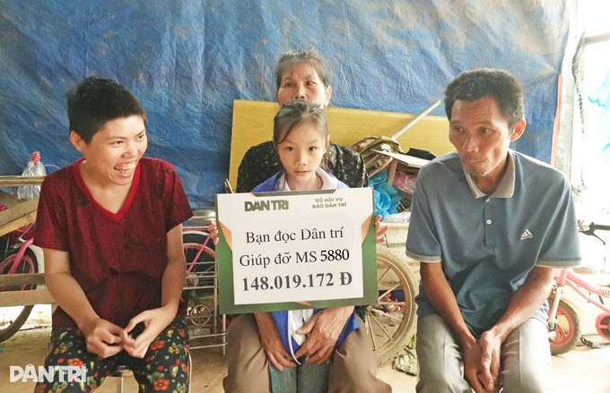 One-eyed woman caring for family receives VND 148 million support - 3