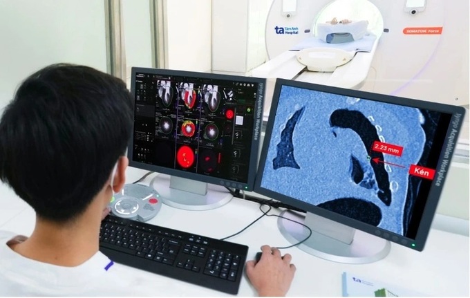 Vietnam debuts world's fastest CT scanner featuring highest slice count - 2