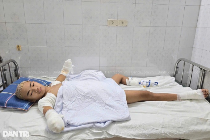 Teenager loses both arms and a leg after electrocution while fishing - 1 Teenager loses both arms and a leg after electrocution while fishing - 1