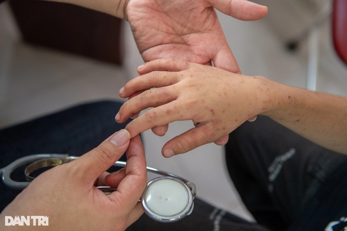 Over 200 students in Nghe An receive free Hepatitis B screenings - 4 Over 200 students in Nghe An receive free Hepatitis B screenings - 4