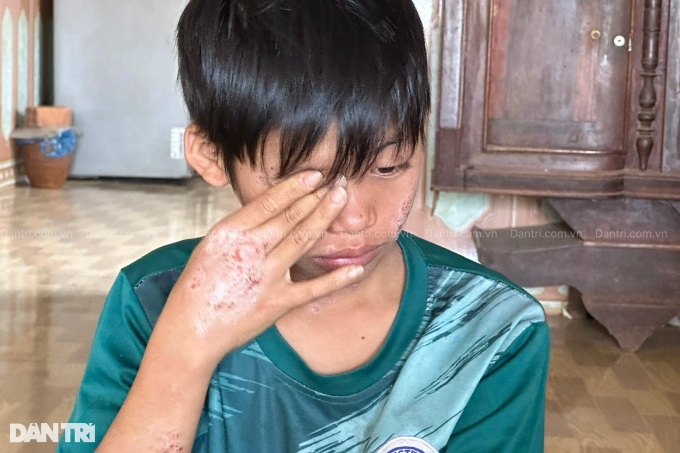 Widowed mother seeks help to save ailing son - 3 Widowed mother seeks help to save ailing son - 3