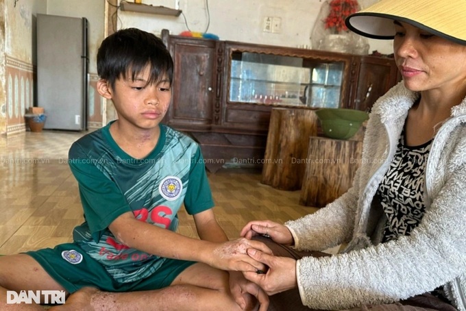 Widowed mother seeks help to save ailing son - 1 Widowed mother seeks help to save ailing son - 1