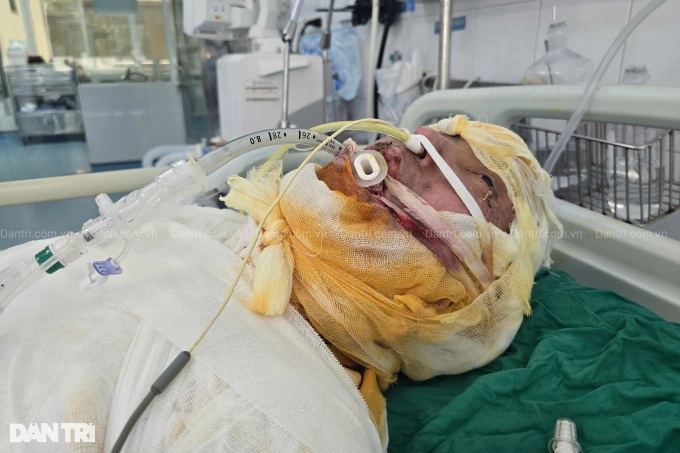 Doctors call for help to save man critically injured by electric burns - 2 Doctors call for help to save man critically injured by electric burns - 2